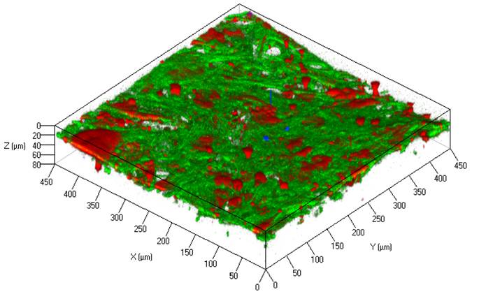 File:Zhao tissue1.jpg