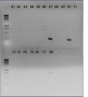 File:03dec09 Gel 3 text.jpg