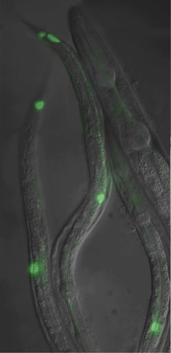 File:GFP neurons.jpg
