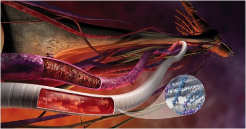 Figure 3. Vascular graft produced by Gore, showing heparin molecules anchored to luminal surface