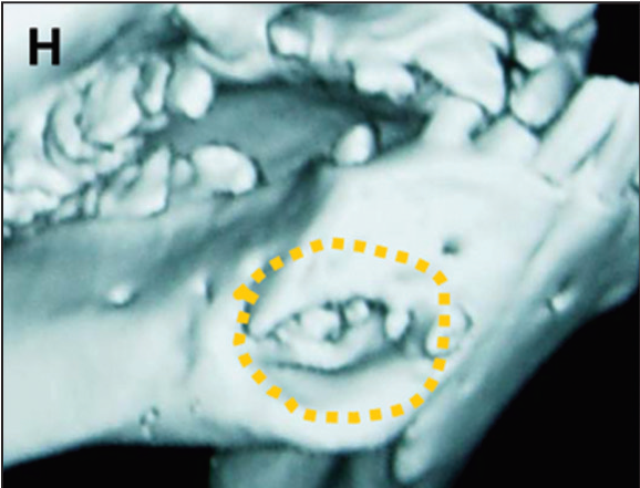 File:Pig teeth control.png