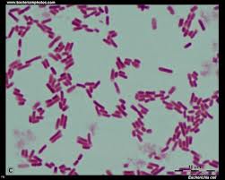 File:E. coli normal cell.jpg