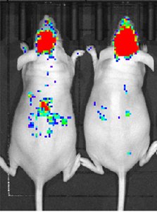 Brain targeted drug delivery
