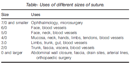 Overview of suture sizes and intended uses.