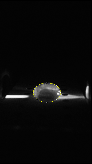 Description of image