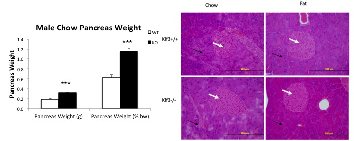 File:Pancreas weight and morphology.jpg