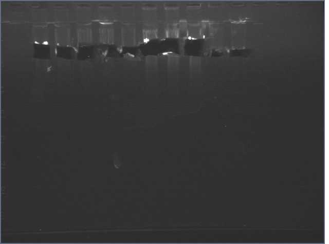 File:6-19-07 gel after excision.jpg