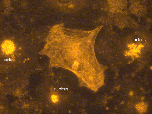 File:401 ceph C-S red 40x 3 2s gain 3-1 flat.jpg