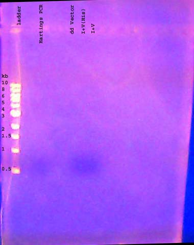 File:DNA gel 110623 annotated.jpg